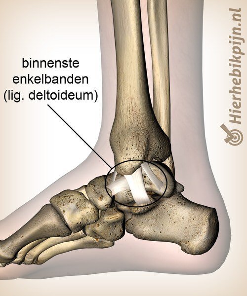 Foto Eversietrauma enkel / mediaal enkelband letsel